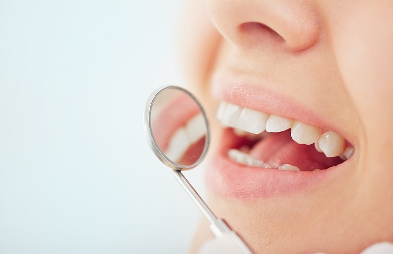 Reminéraliser ses dents : conseils d’experts pour renforcer l’émail