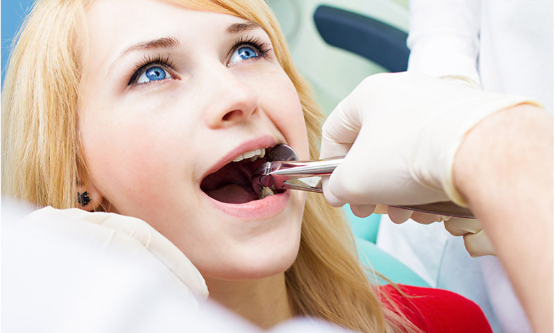 Dents de sagesse : extraction, complications et soins post-opératoires